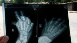 101107_637.jpg 101107_637.jpg