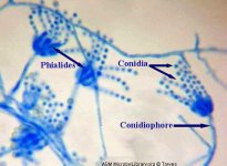 Penicillium_labeled.jpg