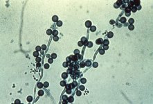 m241-5 Chlamydospores of Candida albicans Goodman.jpg